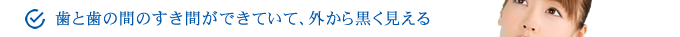 歯と歯の間のすき間ができていて、外から黒く見える。